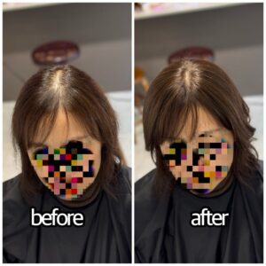 自然な部分ウィッグ オーダーメイドウィッグ